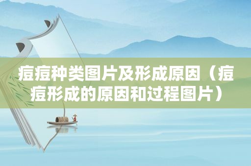 痘痘种类图片及形成原因（痘痘形成的原因和过程图片）