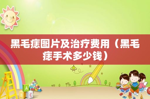 黑毛痣图片及治疗费用（黑毛痣手术多少钱）