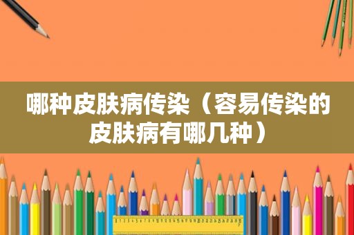 哪种皮肤病传染（容易传染的皮肤病有哪几种）