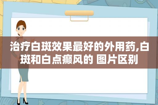 治疗白斑效果最好的外用药,白斑和白点癫风的 图片区别