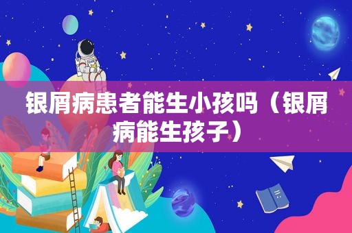 银屑病患者能生小孩吗（银屑病能生孩子）
