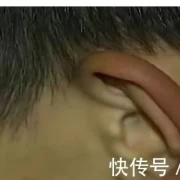 湖南惊现顺风耳！千里之外说话一听便知，医生多次测试难以置信